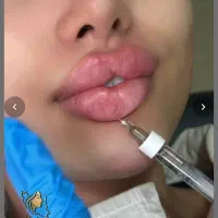 جشنواره ژل و بوتاکس خانوم‌ها و اقایون