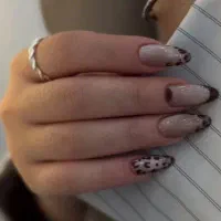 تخفیف ویژه یلدا کاشت و ترمیم ۳۰۰ هزار