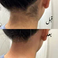 اپیلاسیون و اموزش با مدرک فنی حرفه ای|خدمات آرایشگری و زیبایی|مشهد, گلشور|دیوار