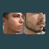 وقتشه چهرهات به بهترین نسخه خودش تبدیل شه