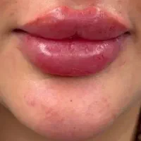 مدل ژل لب روسی۳۵۰ونخ لیفت۷۰۰وو فول فیس وژل بادی۵۰۰|خدمات آرایشگری و زیبایی|تهران, آهنگ|دیوار