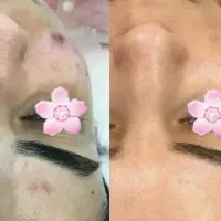 فیشال و مزونیدلینگ پوست و لیفت مژه ابرو و کاشت مژه|خدمات آرایشگری و زیبایی|تهران, تهرانپارس غربی|دیوار