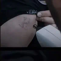 پاک کردن و لیزر تتو