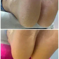 تخفیف ویژه پدیکور پا|خدمات آرایشگری و زیبایی|تبریز, |دیوار