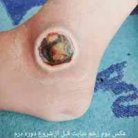 بخیه و تزریقات و پانسمان پیشرفته|خدمات آرایشگری و زیبایی|اهواز, منازل کارون|دیوار