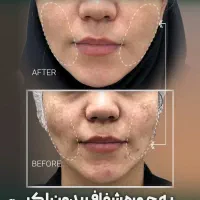 درمان کامل انواع لک پوستی توسط پزشک|خدمات آرایشگری و زیبایی|اصفهان, سعادتآباد|دیوار