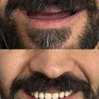 دندانسازی محلات|خدمات آرایشگری و زیبایی|محلات, |دیوار