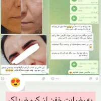 ضدلک لاکچری کوین بدون بازگشت بدون کورتون تضمینی