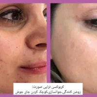 کلینیک پوست،مو،لیزر،لاغری و کربوکسی تراپی|خدمات آرایشگری و زیبایی|کرمان, |دیوار