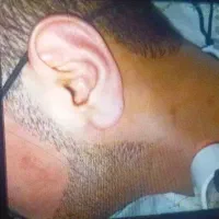 همکاری بااپراتورلیزرموزائدخانم واقادرکلینیک زیبایی