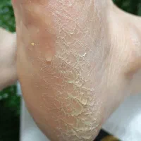 کفسابی پدیکور پارافین تراپی  روشن سازی دست محمدیه|خدمات آرایشگری و زیبایی|محمدیه-قزوین, |دیوار