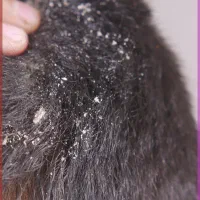 فشیال وپاکسازی واسکالپ سر مخصوص آقایان