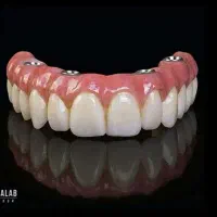 دندان پزشکی.اوردنچر فقط۴۰.اقساط۱۰ماه