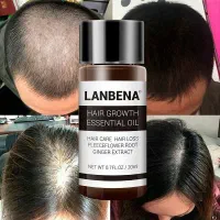 روغن رشد و تقویت مو Lanbena / پرداخت درمحل