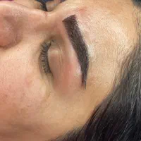 کاشت مو ابرو