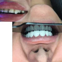 دندانپزشکی