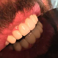 خدمات دندانپزشکی و دندانسازی مستر دِنت|خدمات آرایشگری و زیبایی|ارومیه, |دیوار