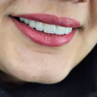 مطب دندانپزشکی طرف قرارداد با بیمه های تکمیلی|خدمات آرایشگری و زیبایی|قزوین, |دیوار