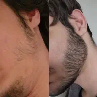 من چی ریشات در میار