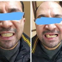 دندانسازی ساخت انواع دندان مصنوعی|خدمات آرایشگری و زیبایی|مشهد, رسالت|دیوار