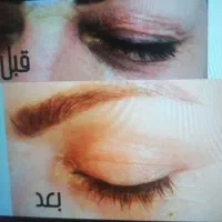 لیزر موهای زائد299هزار، هایفو،سفیدی پوست|خدمات آرایشگری و زیبایی|تبریز, |دیوار