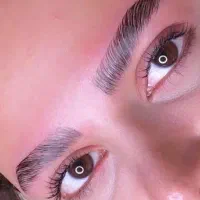 موخوره گیری لیفت ابرومژه ۲۰۰