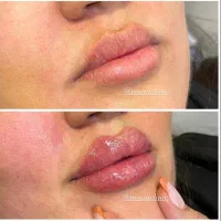 مطبپوست مو لیزر ولاغری|خدمات آرایشگری و زیبایی|مشهد, ایثار|دیوار