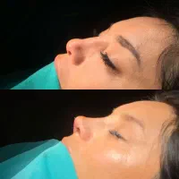 تخفیفات ویژه لیپوماتیک و ابدو و اسلیو اقساطی|خدمات آرایشگری و زیبایی|تهران, میدان ولیعصر|دیوار