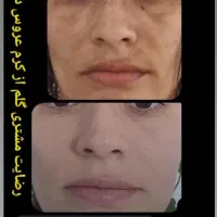 کرم ضد لک قوی عروس دریا