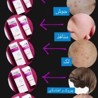 نمایندگی کرم بوتاکس گاتیو(ضدچروک 5کاره