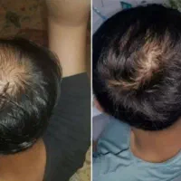 سرسبز|آرایشی، بهداشتی، درمانی|بم, |دیوار