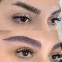مدل فیبروز *میکروبلیدینگ