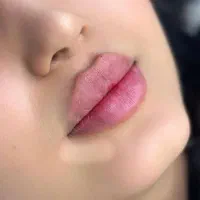 نیازمند مدل برای ژل و بوتاکس