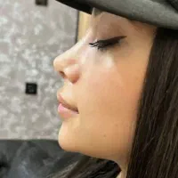 عمل زیبایی بینی ۲۹میلیون