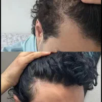 این اقدام آخریشه