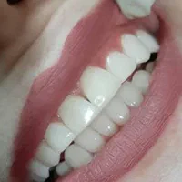 خدمات دندانپزشکی طرح همایتی(نیمه رایگان)|خدمات آرایشگری و زیبایی|کرمانشاه, |دیوار