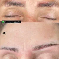 ریموو ابرو و میکروبلیدینگ ابرو