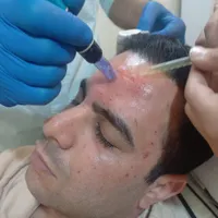 پی ار پی گرینر اتریش جوابدهی انی صورت ،تقویت مو|خدمات آرایشگری و زیبایی|تهران, بهارستان|دیوار