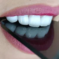 دندانپزشکی ( ایمپلنت ارتودنسی و ..)