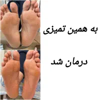 سالن تخصصی پدیکور و مژه گلبهار|خدمات آرایشگری و زیبایی|گلبهار, شهر جدید گلبهار|دیوار