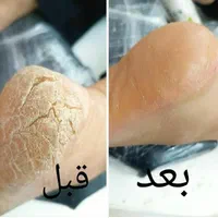 آموزش و خدمات پرسینگ و پدیکورتراپی تخفیف ۸۰ درصدی|خدمات آرایشگری و زیبایی|کرج, باغستان|دیوار