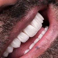 آموزش کاملا حرفه ای و تضمینی کامپوزیت لبه شیشه ای