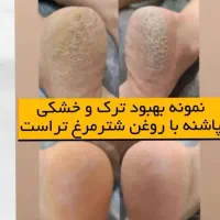 کرم ترکپا وروغن شتر مرغ|آرایشی، بهداشتی، درمانی|تربت جام, جامی|دیوار