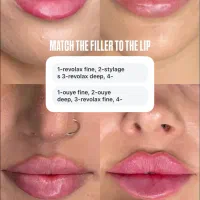 تزریق فیلر و فشیال و بوتاکس وسفیدوتنگ کردن بیکینی