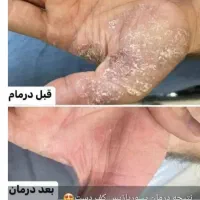 مزاج شناسی و پاکسازی|آرایشی، بهداشتی، درمانی|اهواز, امانیه|دیوار