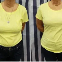 لاغری ۵کیلو|آرایشی، بهداشتی، درمانی|کاشان, مشکات|دیوار