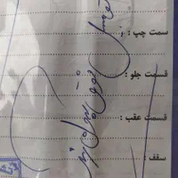 ال نود ۸۷بیرنگ اینه برقی فرمان هیدرولیک شاسی پلمپ|خودرو سواری و وانت|تهران, آهنگ|دیوار