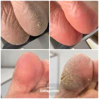 خدمات پدیکور ۴۰۰ تومان|خدمات آرایشگری و زیبایی|خرم‌آباد, |دیوار