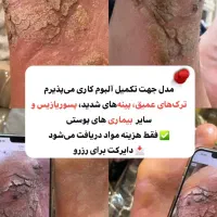 پدیکور