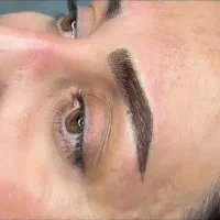 فیبروز ابرو با مواد خارجی